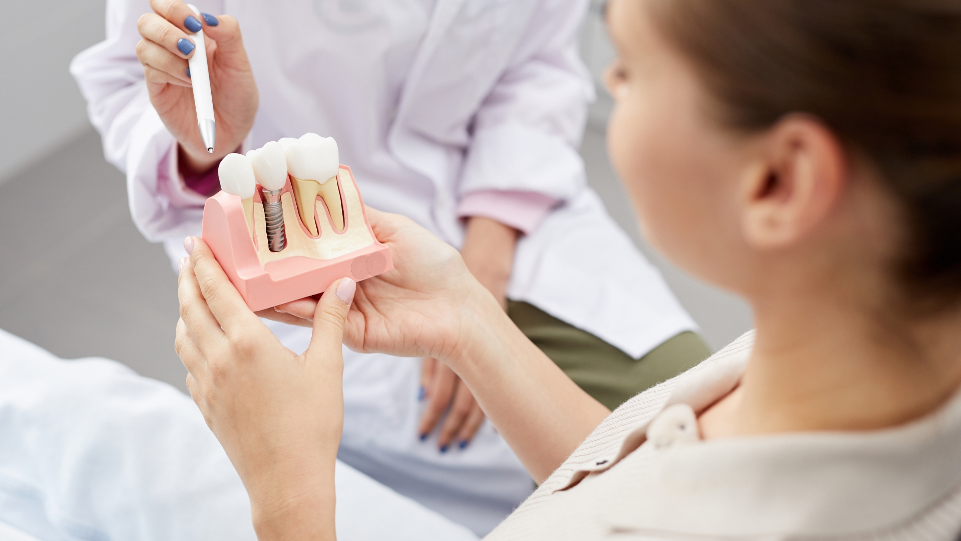 Modern Dental Implants in North London: A Permanent Solution for Missing Teeth